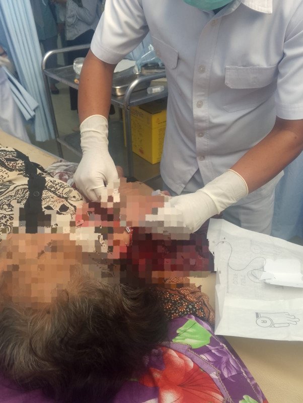 Foto Kondisi Korban Penumpang Carry Yang Ditabrak oleh Truk Pengangkut Udang pada Senin (6/7/2026) Foto Kondisi Korban Penumpang Carry Yang Ditabrak oleh Truk Pengangkut Udang pada Senin (6/7/2026)